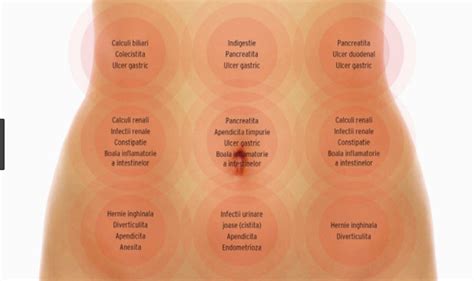 zona abdominala|Abdomenul acut sau durerea abdominala severa